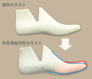 外反母趾対応のラストの右側面から見た模型