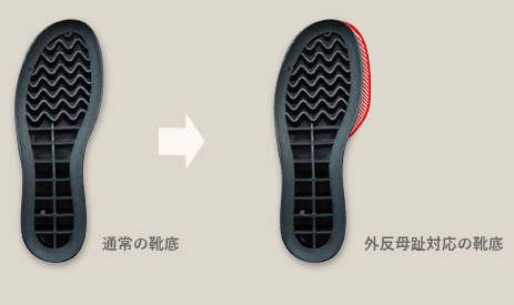 外反母趾対応の靴底の模型