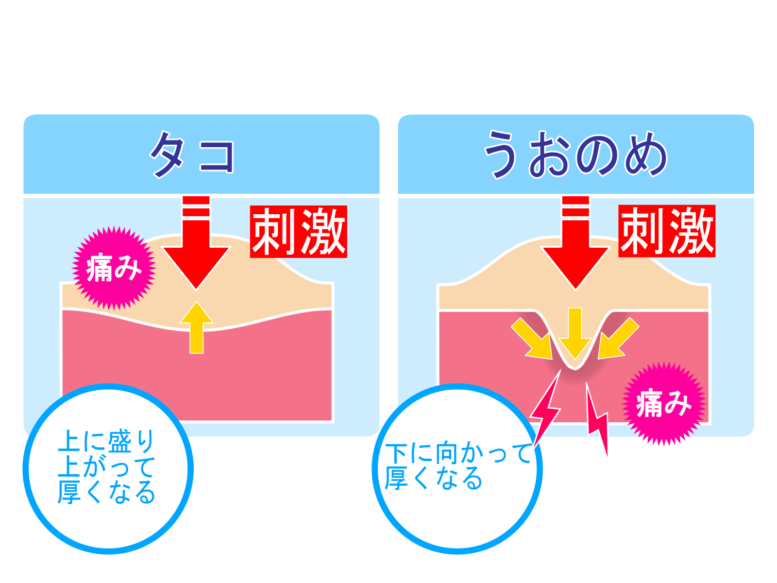 タコと魚の目の比較イラスト